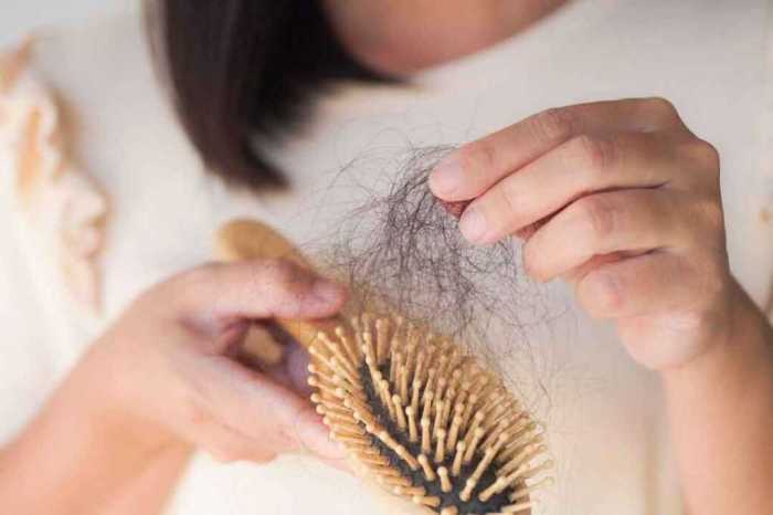 Haaruitval vrouwen haarverlies middenscheiding scalp geld verspillen dure zonder tegengaan aan vrouwelijk patroon steeds wordt volgens breder